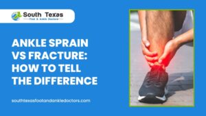 Ankle Sprain vs Fracture