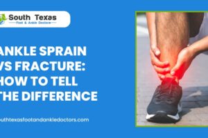 Ankle Sprain vs Fracture
