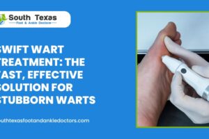 Swift Wart Treatment