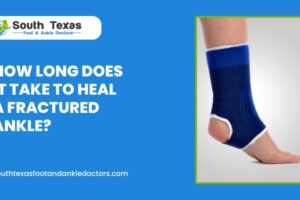 How Long Does It Take to Heal a Fractured Ankle
