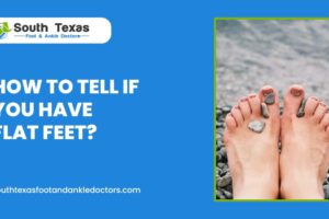 How to Tell If You Have Flat Feet